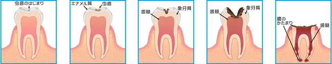 小児イメージ