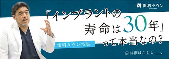 インプラントインタビュー