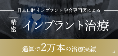 インプラント治療バナー